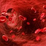 Hemofili (Kanama Bozukluğu) olan Hastalarda Uyutarak Diş Tedavisi
